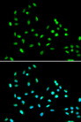 SMARCAD1 Antibody - Immunofluorescence analysis of A549 cells.