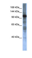 SMARCAL1 Antibody - SMARCAL1 antibody Western blot of Transfected 293T cell lysate. This image was taken for the unconjugated form of this product. Other forms have not been tested.
