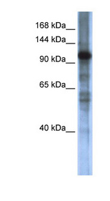 SMARCAL1 Antibody - SMARCAL1 antibody Western blot of Transfected 293T cell lysate. This image was taken for the unconjugated form of this product. Other forms have not been tested.
