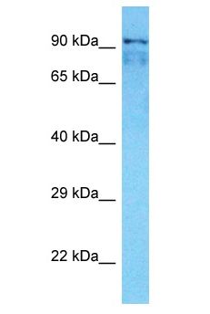 SMARCAL1 Antibody - SMARCAL1 antibody Western Blot of PANC1. Antibody dilution: 1 ug/ml.  This image was taken for the unconjugated form of this product. Other forms have not been tested.