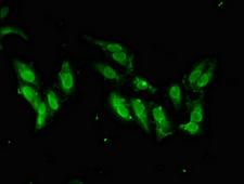 SMARCAL1 Antibody - Immunofluorescent analysis of Hela cells diluted at 1:100 and Alexa Fluor 488-congugated AffiniPure Goat Anti-Rabbit IgG(H+L)