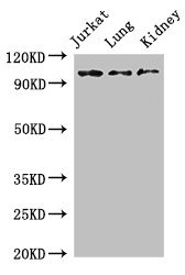 SMARCAL1 Antibody - Western Blot Positive WB detected in:Jurkat whole cell lysate,Mouse lung tissue,Mouse kidney tissue All Lanes:SMARCAL1 antibody at 3µg/ml Secondary Goat polyclonal to rabbit IgG at 1/50000 dilution Predicted band size: 106 KDa Observed band size: 106 KDa