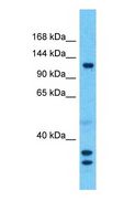 SMARCAL1 Antibody - Western blot of SMARCAL1 Antibody with human Lymph Node Tumor lysate.  This image was taken for the unconjugated form of this product. Other forms have not been tested.