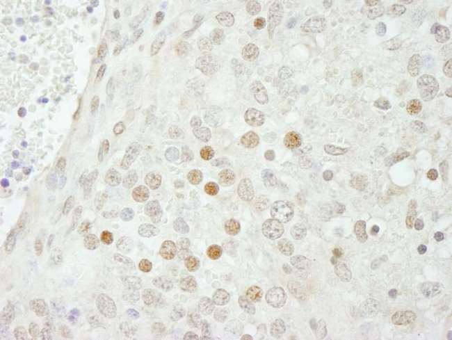 SMARCB1 / INI1 Antibody - Detection of Mouse SMARCB1/SNF5 by Immunohistochemistry. Sample: FFPE section of mouse teratoma. Antibody: Affinity purified rabbit anti-SMARCB1/SNF5 used at a dilution of 1:250.