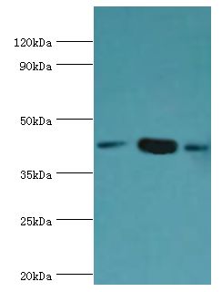 SMARCB1 / INI1 Antibody - Western blot. All lanes: SWI/SNF-related matrix-associated actin-dependent regulator of chromatin subfamily B member 1 antibody at 8 ug/ml. Lane 1: HeLa whole cell lysate. Lane 2: 293T whole cell lysate. Lane 2: mouse stomach tissue. Secondary antibody: Goat polyclonal to rabbit at 1:10000 dilution. Predicted band size: 44 kDa. Observed band size: 44 kDa.