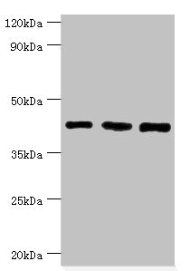 SMARCB1 / INI1 Antibody - Western blot All lanes: SWI/SNF-related matrix-associated actin-dependent regulator of chromatin subfamily B member 1 antibody at 8µg/ml Lane 1: Hela whole cell lysate Lane 2: 293T whole cell lysate Lane 3: Mouse stomach tissue Secondary Goat polyclonal to rabbit IgG at 1/10000 dilution Predicted band size: 45, 44 kDa Observed band size: 45 kDa