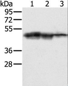 SMARCB1 / INI1 Antibody - Western blot analysis of Hepg2, K562 and Jurkat cell, using SMARCB1 Polyclonal Antibody at dilution of 1:400.