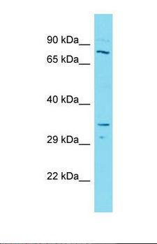 SMARCB1 / INI1 Antibody - Western blot of Human Lymph Node Tumor. SMARCB1 antibody dilution 1.0 ug/ml.  This image was taken for the unconjugated form of this product. Other forms have not been tested.