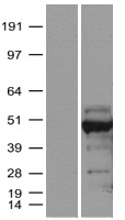 SMARCB1 / INI1 Protein - Western validation with an anti-DDK antibody * L: Control HEK293 lysate R: Over-expression lysate