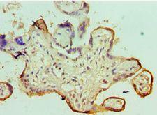 SMARCC1 / SWI3 Antibody - Immunohistochemistry of paraffin-embedded human placenta tissue using antibody at 1:100 dilution.