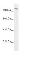 SMARCC1 / SWI3 Antibody - Jurkat Cell Lysate.  This image was taken for the unconjugated form of this product. Other forms have not been tested.