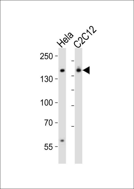 SMARCC1 / SWI3 Antibody - Western blot of lysates from HeLa, mouse C2C12 cell line (from left to right) with Smarcc1 Antibody. Antibody was diluted at 1:1000 at each lane. A goat anti-rabbit IgG H&L (HRP) at 1:10000 dilution was used as the secondary antibody. Lysates at 20 ug per lane.
