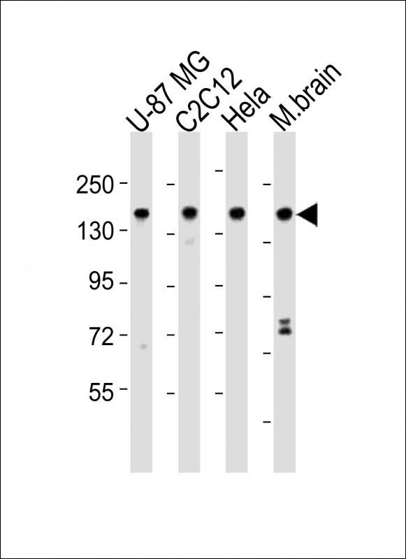 SMARCC1 / SWI3 Antibody - All lanes : Anti-SMARCC1 Antibody at 1:2000 dilution Lane 1: U-87 MG whole cell lysates Lane 2: C2C12 whole cell lysates Lane 3: HeLa whole cell lysates Lane 4: mouse brain lysates Lysates/proteins at 20 ug per lane. Secondary Goat Anti-Rabbit IgG, (H+L), Peroxidase conjugated at 1/10000 dilution Predicted band size : 123 kDa Blocking/Dilution buffer: 5% NFDM/TBST.