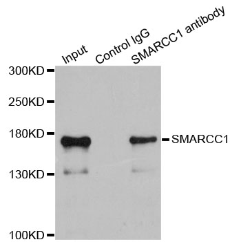 SMARCC1 / SWI3 Antibody - Immunoprecipitation analysis of 200ug extracts of 293T cells.