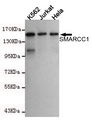 SMARCC1 / SWI3 Antibody - Western blot detection of SMARCC1 in K562, Jurkat and HeLa cell lysates using SMARCC1 mouse monoclonal antibody (1:1000 dilution). Predicted band size: 155KDa. Observed band size:155KDa.