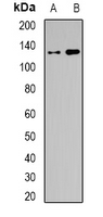 SMARCC1 / SWI3 Antibody - Western blot analysis of BAF155 expression in SW620 (A); HEK293T (B) whole cell lysates.