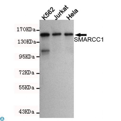 SMARCC1 / SWI3 Antibody - Western blot detection of SMARCC1 in K562, Jurkat and Hela cell lysates using SMARCC1 mouse mAb (1:1000 diluted). Predicted band size: 155KDa. Observed band size: 155KDa.