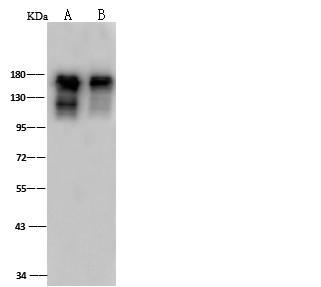 SMARCC1 / SWI3 Antibody - Anti-SMARCC1 rabbit polyclonal antibody at 1:500 dilution. Lane A: HeLa Whole Cell Lysate. Lane B: U-87MG Whole Cell Lysate. Lysates/proteins at 30 ug per lane. Secondary: Goat Anti-Rabbit IgG (H+L)/HRP at 1/10000 dilution. Developed using the ECL technique. Performed under reducing conditions. Predicted band size: 123 kDa. Observed band size: 150 kDa.