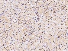 SMARCC1 / SWI3 Antibody - Immunochemical staining of human SMARCC1 in human kidney with rabbit polyclonal antibody at 1:1000 dilution, formalin-fixed paraffin embedded sections.
