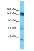 SMARCC2 Antibody - SMARCC2 antibody Western Blot of HepG2. Antibody dilution: 1 ug/ml.  This image was taken for the unconjugated form of this product. Other forms have not been tested.