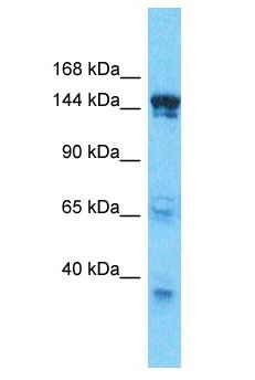 SMARCC2 Antibody - SMARCC2 antibody Western Blot of HepG2. Antibody dilution: 1 ug/ml.  This image was taken for the unconjugated form of this product. Other forms have not been tested.