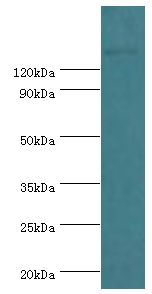 SMARCC2 Antibody - Western blot. All lanes: SWI/SNF complex subunit SMARCC2 antibody at 2 ug/ml+mouse liver tissue. Secondary antibody: Goat polyclonal to rabbit at 1:10000 dilution. Predicted band size: 133 kDa. Observed band size: 133 kDa.