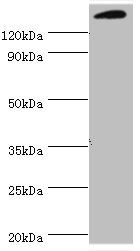 SMARCC2 Antibody - Western blot All lanes: SWI/SNF complex subunit SMARCC2 antibody at 2µg/ml + Mouse liver tissue Secondary Goat polyclonal to rabbit IgG at 1/10000 dilution Predicted band size: 133, 125, 127 kDa Observed band size: 133 kDa