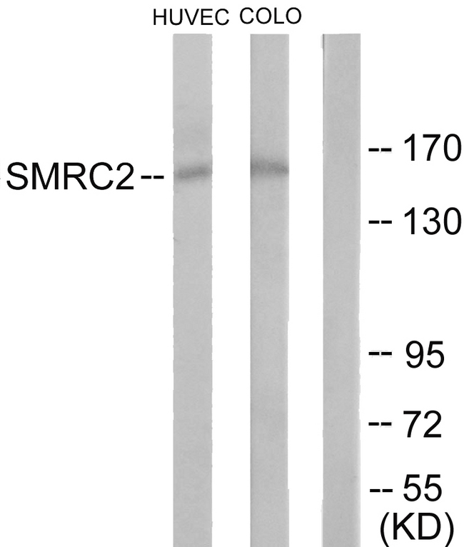 SMARCC2 Antibody - Western blot analysis of lysates from HUVEC and COLO205 cells, using SMRC2 Antibody. The lane on the right is blocked with the synthesized peptide.