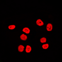 SMARCC2 Antibody - Immunofluorescent analysis of BAF170 staining in Raji cells. Formalin-fixed cells were permeabilized with 0.1% Triton X-100 in TBS for 5-10 minutes and blocked with 3% BSA-PBS for 30 minutes at room temperature. Cells were probed with the primary antibody in 3% BSA-PBS and incubated overnight at 4 C in a humidified chamber. Cells were washed with PBST and incubated with a DyLight 594-conjugated secondary antibody (red) in PBS at room temperature in the dark. DAPI was used to stain the cell nuclei (blue).