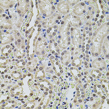 SMARCC2 Antibody - Immunohistochemistry of paraffin-embedded rat kidney tissue.