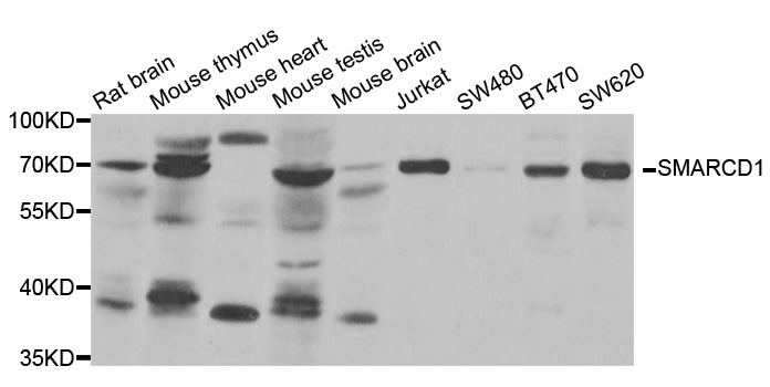 SMARCD1 / BAF60A Antibody - Western blot analysis of extracts of various cell lines.