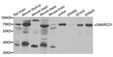SMARCD1 / BAF60A Antibody - Western blot analysis of extracts of various cell lines.