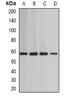 SMARCD1 / BAF60A Antibody - Western blot analysis of BAF60A expression in Jurkat (A); mouse heart (B); mouse testis (C); rat brain (D) whole cell lysates.