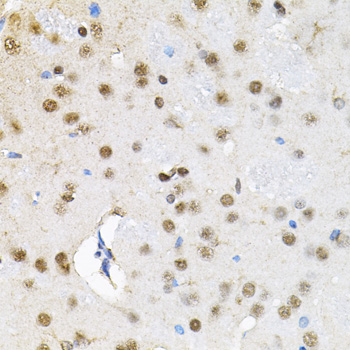 SMARCD1 / BAF60A Antibody - Immunohistochemistry of paraffin-embedded rat brain tissue.