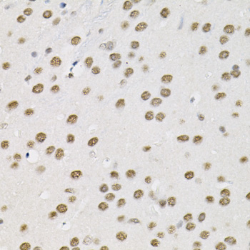 SMARCD1 / BAF60A Antibody - Immunohistochemistry of paraffin-embedded mouse brain tissue.