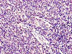 SMARCD1 / BAF60A Antibody - Immunohistochemistry image of paraffin-embedded human lymph node tissue at a dilution of 1:100