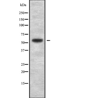 SMARCD1 / BAF60A Antibody - Western blot analysis SMARCD1/3 using HepG2 whole cells lysates