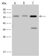 SMARCD1 / BAF60A Antibody - Anti-SMARCD1 rabbit polyclonal antibody at 1:500 dilution. Lane A: HeLa Whole Cell Lysate. Lane B: NIH-3T3 Whole Cell Lysate. Lane C: U-251 MG Whole Cell Lysate. Lysates/proteins at 30 ug per lane. Secondary: Goat Anti-Rabbit IgG (H+L)/HRP at 1/10000 dilution. Developed using the ECL technique. Performed under reducing conditions. Predicted band size: 58 kDa. Observed band size: 58 kDa.