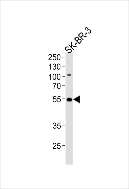 SMARCE1 / BAF57 Antibody - Western blot of lysate from SK-BR-3 cell line, using SMARCE1 Antibody. Antibody was diluted at 1:1000 at each lane. A goat anti-rabbit IgG H&L (HRP) at 1:5000 dilution was used as the secondary antibody. Lysate at 35ug per lane.