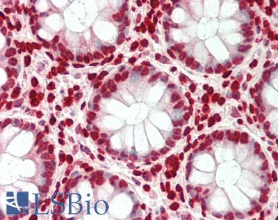 SMARCE1 / BAF57 Antibody - Human Colon: Formalin-Fixed, Paraffin-Embedded (FFPE).  This image was taken for the unconjugated form of this product. Other forms have not been tested.