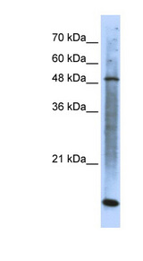 SMARCE1 / BAF57 Antibody - SMARCE1 antibody western blot of Transfected 293T cell lysate.  This image was taken for the unconjugated form of this product. Other forms have not been tested.