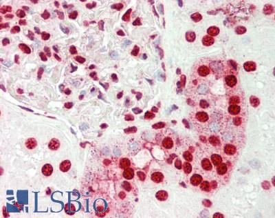 SMARCE1 / BAF57 Antibody - Human Kidney: Formalin-Fixed, Paraffin-Embedded (FFPE).  This image was taken for the unconjugated form of this product. Other forms have not been tested.