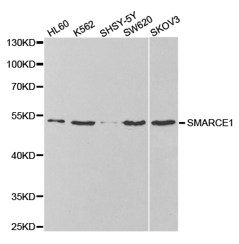 SMARCE1 / BAF57 Antibody - Western blot analysis of extracts of various cell lines.