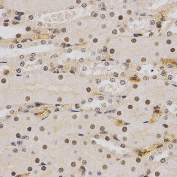 SMARCE1 / BAF57 Antibody - Immunohistochemistry of paraffin-embedded mouse kidney tissue.