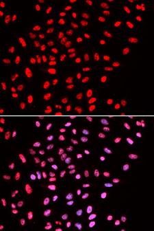 SMARCE1 / BAF57 Antibody - Immunofluorescence analysis of U2OS cells.