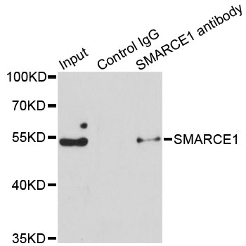 SMARCE1 / BAF57 Antibody - Immunoprecipitation analysis of 150ug extracts of Jurkat cells.