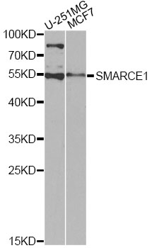 SMARCE1 / BAF57 Antibody - Western blot analysis of extracts of various cell lines, using SMARCE1 antibody at 1:1000 dilution. The secondary antibody used was an HRP Goat Anti-Rabbit IgG (H+L) at 1:10000 dilution. Lysates were loaded 25ug per lane and 3% nonfat dry milk in TBST was used for blocking. An ECL Kit was used for detection and the exposure time was 90s.