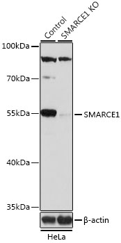 SMARCE1 / BAF57 Antibody - Western blot analysis of extracts from normal (control) and SMARCE1 knockout (KO) HeLa cells, using SMARCE1 antibody at 1:1000 dilution. The secondary antibody used was an HRP Goat Anti-Rabbit IgG (H+L) at 1:10000 dilution. Lysates were loaded 25ug per lane and 3% nonfat dry milk in TBST was used for blocking. An ECL Kit was used for detection and the exposure time was 15s.
