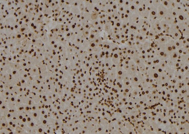 SMARCE1 / BAF57 Antibody - 1:100 staining mouse liver tissue by IHC-P. The sample was formaldehyde fixed and a heat mediated antigen retrieval step in citrate buffer was performed. The sample was then blocked and incubated with the antibody for 1.5 hours at 22°C. An HRP conjugated goat anti-rabbit antibody was used as the secondary.