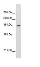 SMARCE1 / BAF57 Antibody - Jurkat Cell Lysate.  This image was taken for the unconjugated form of this product. Other forms have not been tested.
